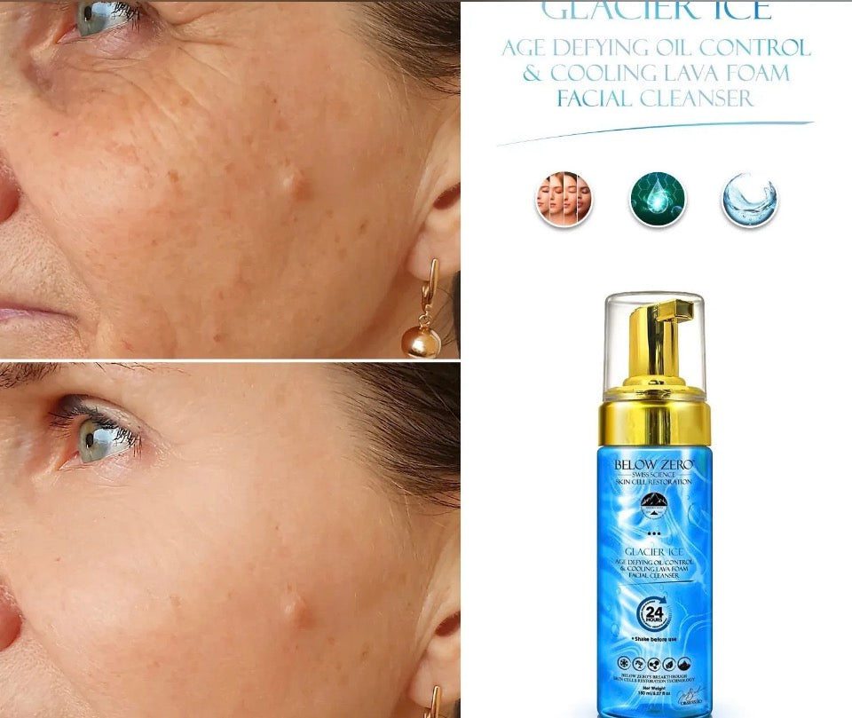 Before and after results with Below Zero Glacier Ice Cleanser - clearer skin and product benefits