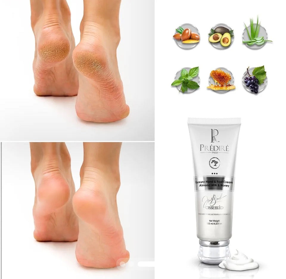 Before and after cracked heel results with key ingredients - Prédiré Paris Hand & Foot Cream