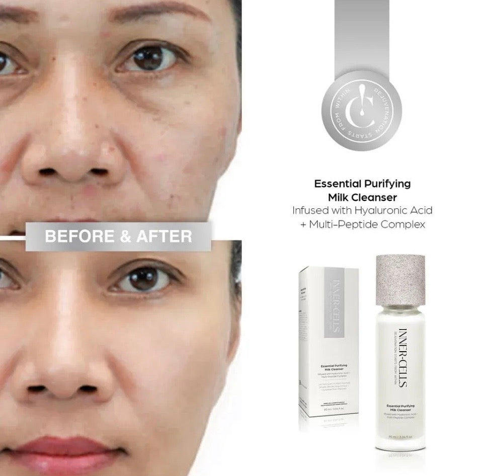 Before and after with Inner-Cells Essential Purifying Milk Cleanser - visibly clearer, more even skin tone and reduced dark circles