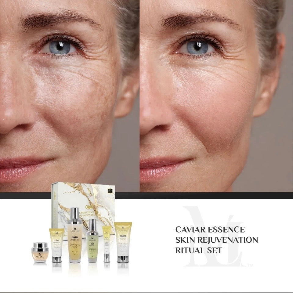 Before and after with Latoua Millé Caviar Essence Skin Rejuvenation Ritual Set - visibly reduced fine lines and wrinkles with firmer, more youthful skin