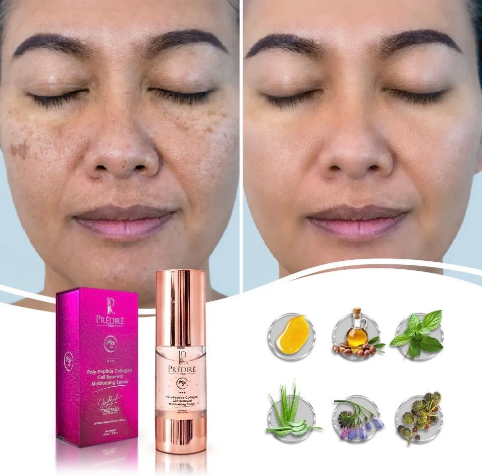 Before and after with Prédiré Paris Poly-Peptide Collagen Cell Renewal Serum - visibly reduced dark spots and hyperpigmentation with key botanical ingredients