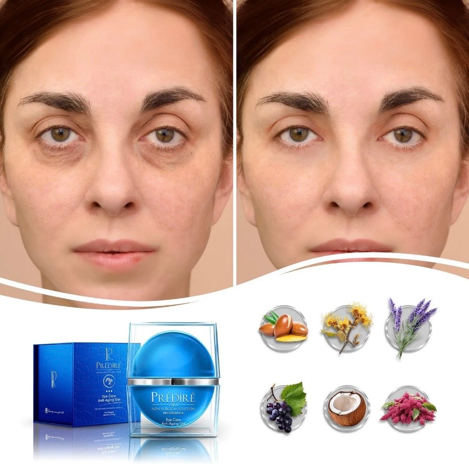 Before and after with Prédiré Paris Eye Care Intensive Rescue Gel - reduced dark circles and puffiness, with key botanical ingredients