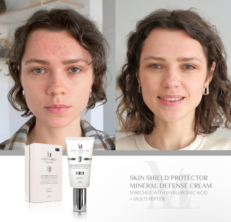 Before and after with Látoüa Mille Skin Shield Protector - visibly reduced acne redness and more even skin tone with product and gift box shown below