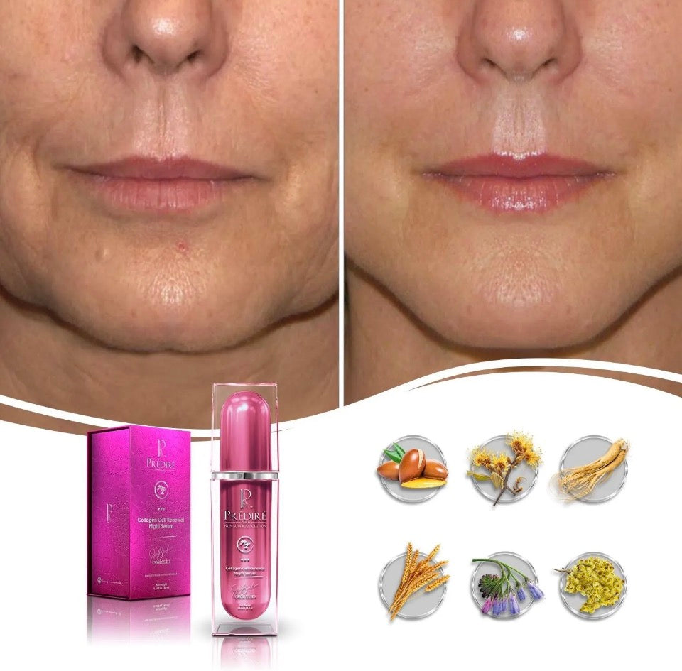 Prédiré Paris Collagen Cell Renewal Night Serum - before and after showing dramatic nasolabial fold and jowl reduction with 6 botanical ingredients Argan Oil Helichrysum Ginseng Wheat Lavender Chamomile