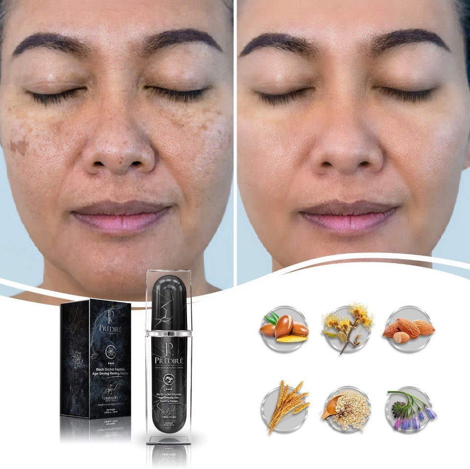 Prédiré Paris Black Orchid Peptide Age-Defying Skin Firming Serum - before and after showing dramatic dark spot and hyperpigmentation correction with key botanical ingredients Argan Oil Helichrysum Almond Wheat Oat Sesame Lavender