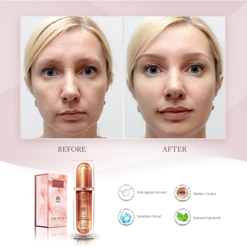 Prédiré Paris Snail Mucin Serum – before and after with key benefits